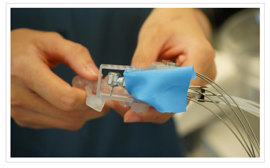 A Tiny Robot Could Transform Dental Crown Procedures: The Future of One-Visit Dentistry?